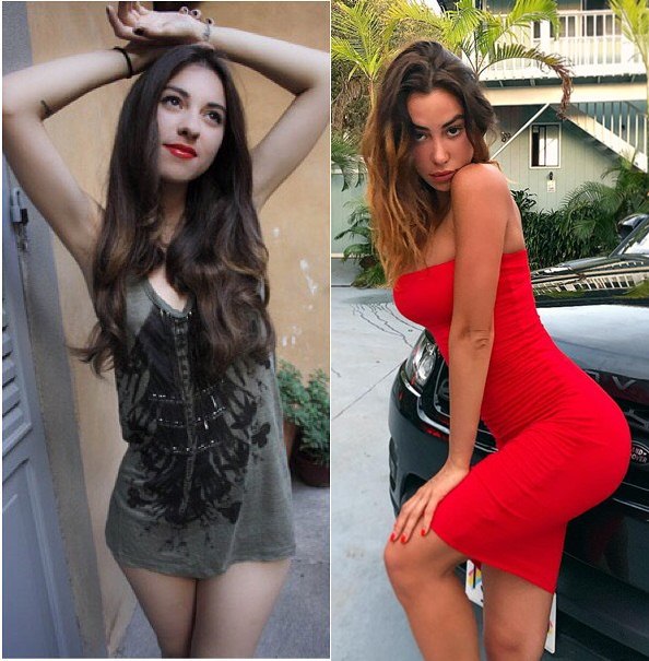 Valentina Fradegrada Before & After Picture